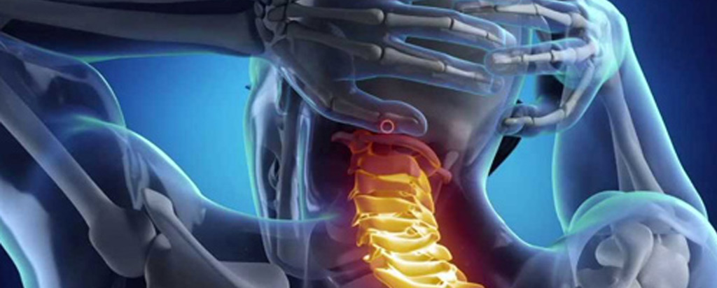 Neck Pain Chicago