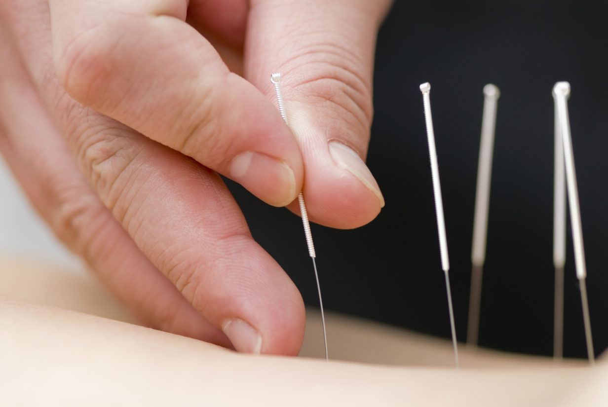 Acupuncture Downtown Chicago• Ambetter Insurance Acupuncture Chicago