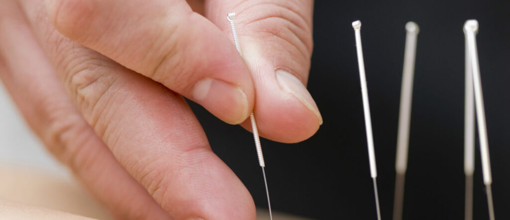 Ambetter Insurance Acupuncture